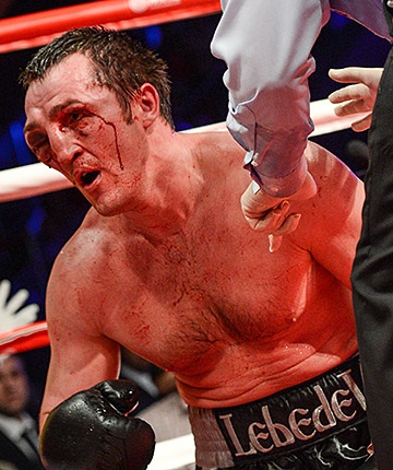 Olvasó - veresége Denis Lebedev (z amerikai ügynökség) Olvasó - a vereség Denis Lebedev