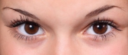 Mi köze a száraz bőrt a szem körül