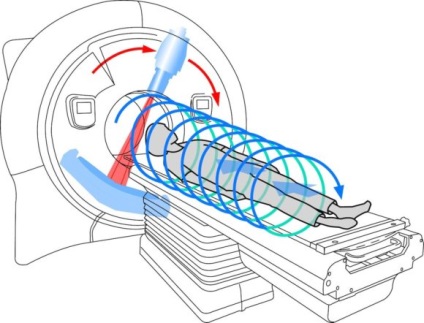 Ami különösen MSCT diagnosztikai eljárás és annak előnyeit (a) Mi különösen MSCT diagnosztikai eljárás és annak előnyeit