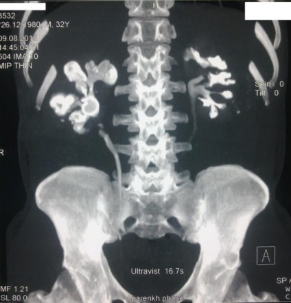 Mi különösen MSCT diagnosztikai eljárás és annak előnyeit