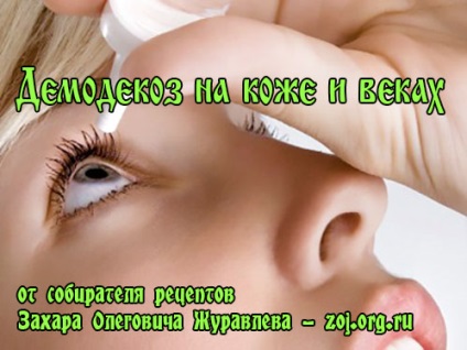Akne szembe egy személy - tippeket kezelés otthoni kezelés () Akne szembe egy személy - tippeket kezelés kezelés otthon