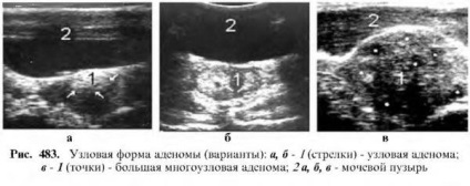 Diagnózis a prosztata betegségek (diagnosztikája prosztata betegségek) Diagnózisa prosztata betegségek
