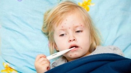 Diéta gyermekekben bárányhimlő varicella teljesítmény, milyen étel lehet enni (gyermek) Diéta gyermekekben bárányhimlő varicella teljesítmény, milyen étel lehet enni