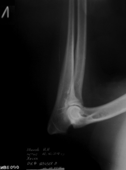 Dysplasia, diszplázia vizsgálat, ellenőrzés, dysplasia, hd (327-29-73 ellenőrzik) Dysplasia, diszplázia vizsgálat, ellenőrzés, dysplasia, hd