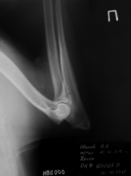 Dysplasia, diszplázia vizsgálat, ellenőrzés, dysplasia, hd (327-29-73 ellenőrzik) Dysplasia, diszplázia vizsgálat, ellenőrzés, dysplasia, hd