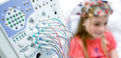 Brain EEG gyerekek, hogyan kell csinálni, azt mutatja, (mutatja) Brain EEG gyerekek, hogyan kell csinálni, azt mutatja,