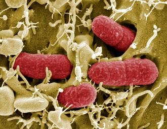 Escherichia coli kezelés - gyönyörű divat