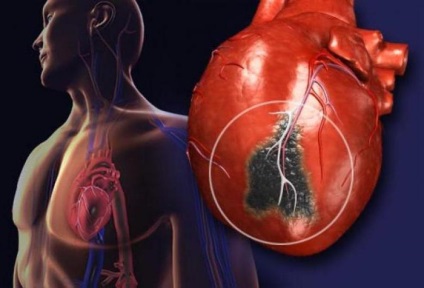 Ejekciós frakció a szívfrekvencia és patológia