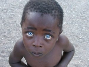 Kék szeme a lányok és a fiúk