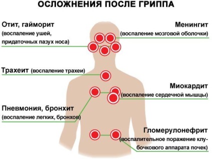 Milyen gyorsan erősíti az immunrendszert, miután az influenza minden módon és eszközökkel