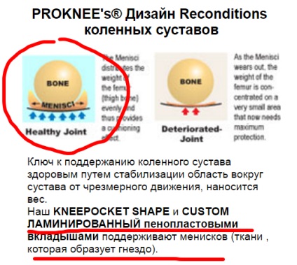 Hogyan válasszuk ki egy építőipari kneepads (térd) Hogyan válasszuk ki egy építőipari térdvédőt