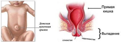 Szamárköhögés szövődmények, prognózis és az immunitás