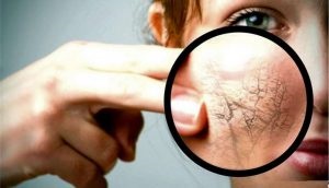 Psoriasis kezelése homeopátia - módszert is kidolgoztunk, a betegség, válaszok (kezelés) Psoriasis kezelése homeopátia - módszert is kidolgoztunk, a betegség, vélemények