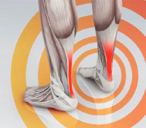 A kezelés a ragadós tendinitis (gyulladás az ín) (íngyulladás) A kezelés a ragadós tendinitis (íngyulladás)