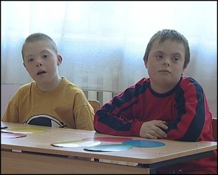 Extra kromoszóma egy humán kromoszóma emberi betegségek, két narancs (betegség) Extra kromoszóma egy humán kromoszóma emberi betegségek, két narancs