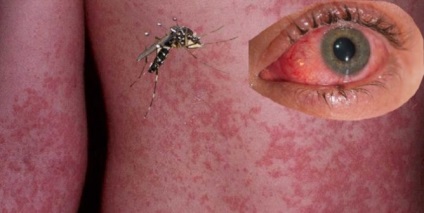 Anopheles szúnyog és veszély az emberre (kockázati) Anopheles szúnyog és a veszély az emberre