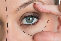 Myasthenia gravis - ocularis formában a betegség (myasthenia gravis okuláris formájában tünetek) Myasthenia gravis - ocularis formában a betegség