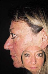 Emberek hyperthyreosis kezelés () Népi kezelésére hyperthyreosis