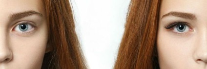 Lashes (fotók előtt és után) (szempillák) Lashes (előtti és utáni képek)