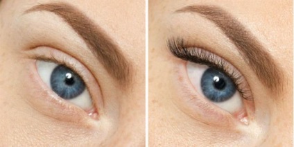 Lashes (fotók előtt és után) (Naroscheny) Lashes (előtti és utáni képek)