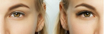 Lashes (fotók előtt és után) (utána) Lashes (előtti és utáni képek)