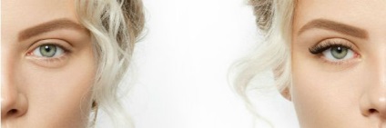 Lashes (fotók előtt és után) (Naroscheny) Lashes (előtti és utáni képek)