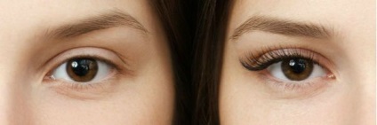 Lashes (fotók előtt és után) (Naroscheny) Lashes (előtti és utáni képek)