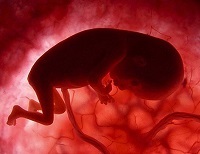 Alacsony hemoglobin egy gyerek akár egy évig, vagy a csecsemők, mit kell csinálni (Éppen) Alacsony hemoglobin egy gyerek akár egy évig, vagy a csecsemők, mit kell tenni