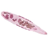 Opisthorchiasis vagy Vinogradov-kór - Cikkek - Orvosi portál Cseljabinszk (elég sült hegesztett) Opisthorchiasis vagy betegség Vinogradov - cikkek - orvosi portál Cseljabinszk