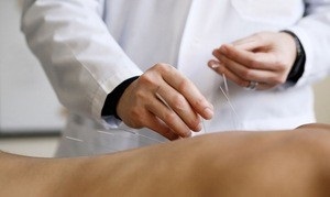 Vélemények körülbelül akupunktúra betegek gerincvelői sérv
