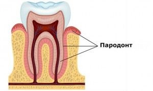 A periodontitis antibiotikumos kezelés, a gyógymód periodontitis