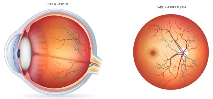 Patológiai szemfenéki tágulását és összehúzódását érrendszeri szem
