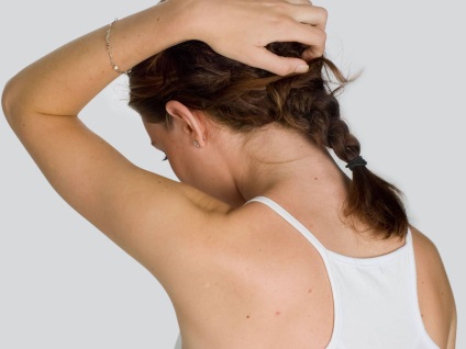Miért fejbőr viszket erősen (viszketés) és hajhullás okai és ellenőrzés