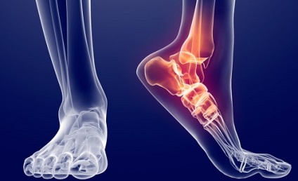 Jelzések az MRI a láb és a boka (bizonyság) Jelzések az MRI a láb és a boka