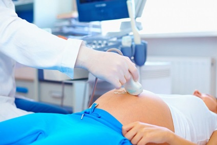 Placenta previa típusú és mértékű okoz, milyen veszélyes, diagnózis és kezelés (fok) Placenta previa típusú és mértékű okoz, milyen veszélyes, diagnózis és kezelés