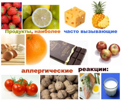 Akne édes - fotók, miért jelennek meg az arcon, lehet, mint megszabadulni a (fotók) Akne édes - fotók, miért jelennek meg az arcon, lehet, hogyan lehet megszabadulni