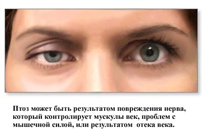 a kezelés a szem népi jogorvoslat a diabetes)