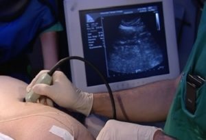 vese szúrás - akit kinevezett kész, ellenjavallatok (kijelölt) vese szúrás - akit kinevezett történik, ellenjavallatok