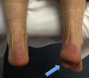 mit kezelnek a térdízület fájdalma szimmetrikus fájdalom a lábak ízületeiben