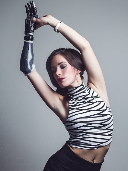 Rebekah tengeri - protézissel modell (modell) Rebekah tengeri - egy modell protézis