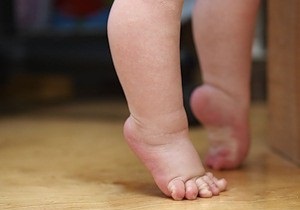 A gyermek sétál lábujjak miatt hibás beállítása a láb
