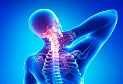 Nyaki osteochondrosis okoz, tünetek és rehabilitáció (nyaki gerinc) Nyaki osteochondrosis okoz, tünetek és fizikoterápiás