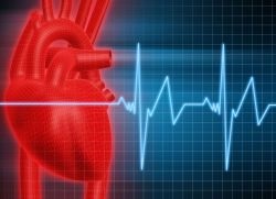 Sinus arrhythmia (sinus) sinus arrhythmia