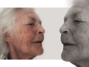 A szenilis szemölcsök (életkor keratomas) kép, a kezelés a népi jogorvoslat, ott lehet következtetni