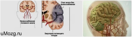 Leszűkítése cerebrovaszkuláris kezelést népi jogorvoslat és a gyógyszerek (szűkület) Leszűkítése cerebrovascularis kezelés népi jogorvoslati és a kábítószer