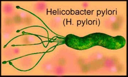 Tablettákat Helicobacter pylori és a hagyományos gyógyszerek