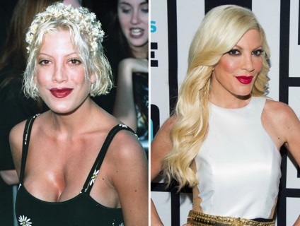 Tori Spelling előtt és után műanyag - 300 ( Tori Spelling előtt és után műanyag - 300