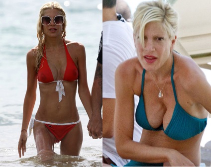 Tori Spelling előtt és után műanyag - 300 (helyesírás) Tori Spelling előtt és után műanyag - 300
