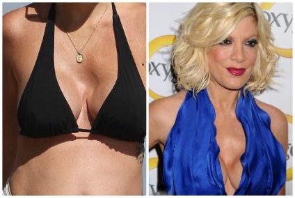 Tori Spelling, miután számos műveletek és plastik- fotók és videók