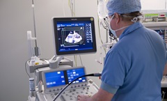 Szív ultrahang - a jelzések, technikák